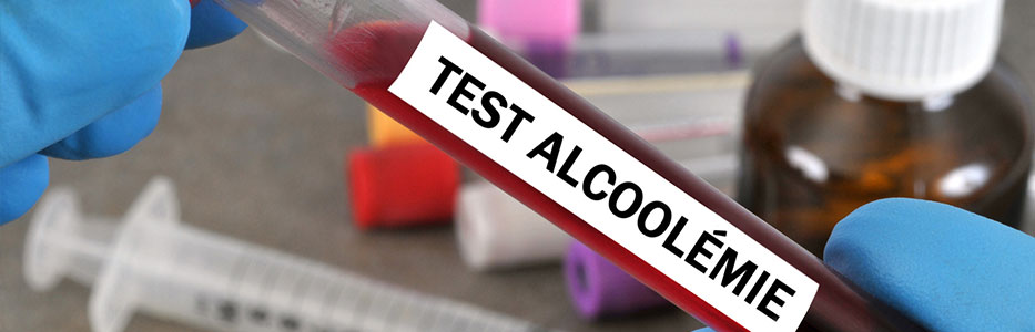 Prise de sang pour alcool au volant
